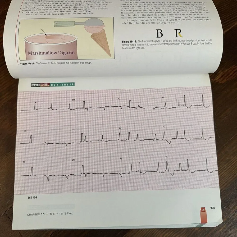 12-Lead ECG: The Art of Interpretation by Garcia & Holtz